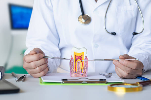 Best Knocked-Out Tooth (Avulsed Tooth) Treatment in Fairport, NY